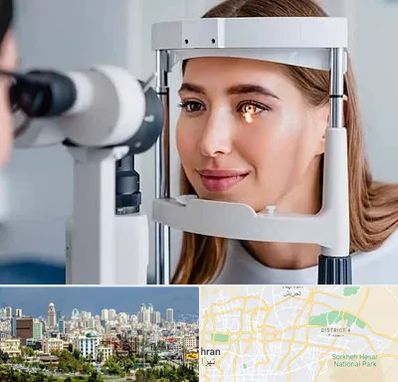 دکتر قوز قرنیه در شرق تهران