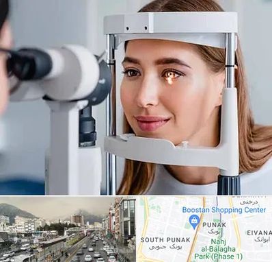 دکتر قوز قرنیه در پونک