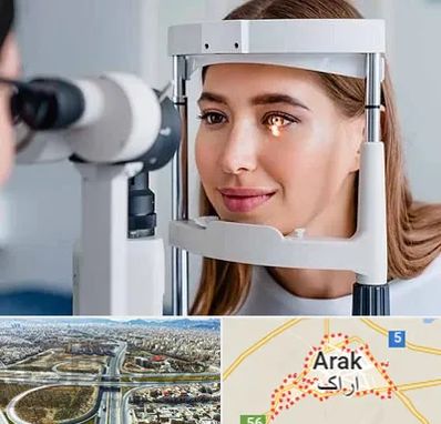 دکتر قوز قرنیه در اراک