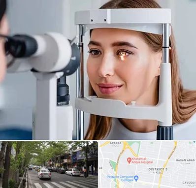 دکتر قوز قرنیه در ظفر