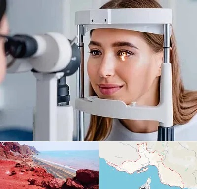 دکتر قوز قرنیه در هرمزگان
