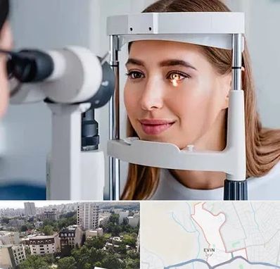 دکتر قوز قرنیه در اوین