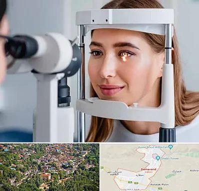 دکتر قوز قرنیه در دماوند