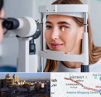 دکتر قوز قرنیه در فرمانیه