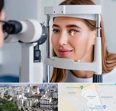 دکتر قوز قرنیه در ولنجک