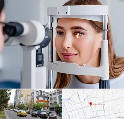 دکتر قوز قرنیه در هفده شهریور تبریز