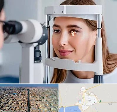 دکتر قوز قرنیه در بندر ماهشهر