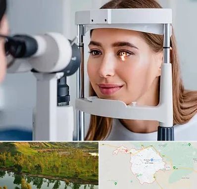 دکتر قوز قرنیه در بهبهان