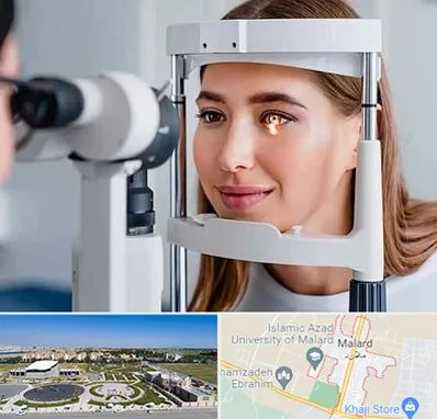 دکتر قوز قرنیه در ملارد