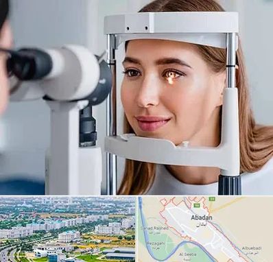 دکتر قوز قرنیه در آبادان