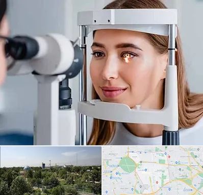 دکتر قوز قرنیه در منطقه 16 تهران