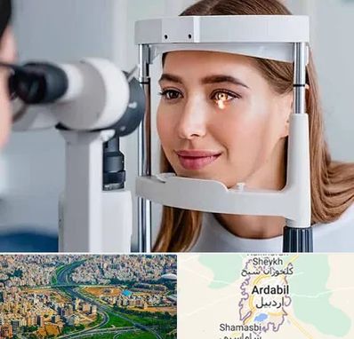 دکتر قوز قرنیه در اردبیل