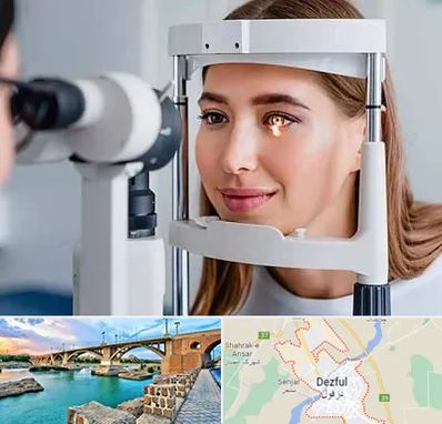 دکتر قوز قرنیه در دزفول