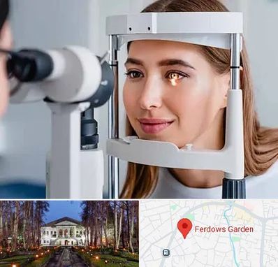 دکتر قوز قرنیه در باغ فردوس