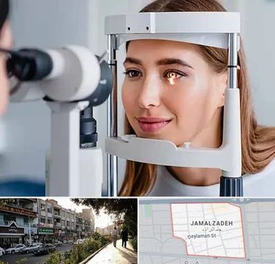 دکتر قوز قرنیه در خیابان جمالزاده