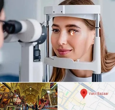 دکتر قوز قرنیه در بازار وکیل شیراز