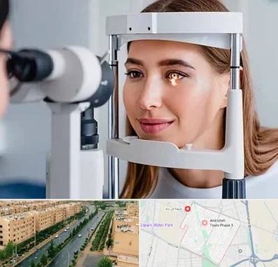 دکتر قوز قرنیه در فاز سه اندیشه