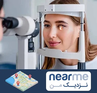 دکتر قوز قرنیه در نزدیک من