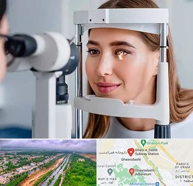 دکتر قوز قرنیه در قصرالدشت شیراز