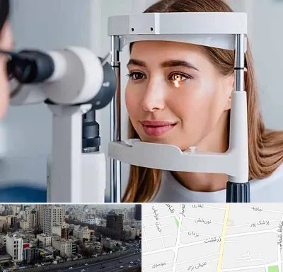 دکتر قوز قرنیه در زرتشت