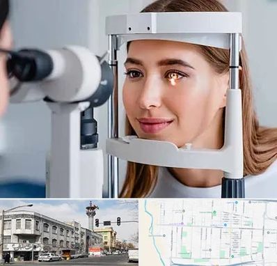 دکتر قوز قرنیه در 17شهریور