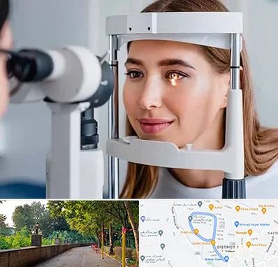 دکتر قوز قرنیه در فلکه گاز رشت