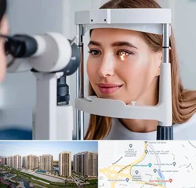 دکتر قوز قرنیه در المپیک