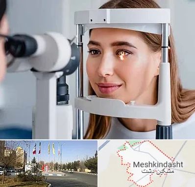 دکتر قوز قرنیه در مشکین دشت