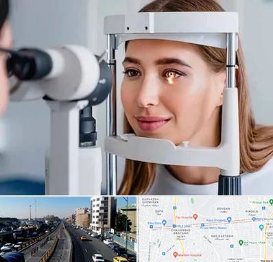 دکتر قوز قرنیه در پیروزی