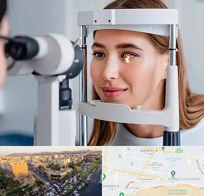 دکتر قوز قرنیه در تهرانپارس