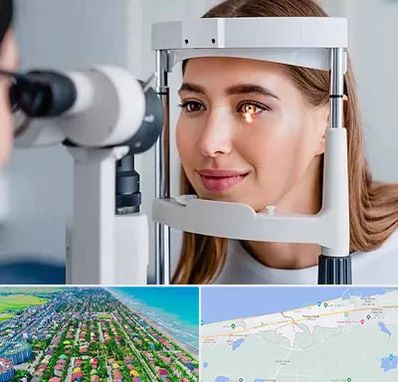 دکتر قوز قرنیه در فریدونکنار