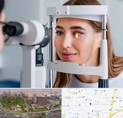 دکتر قوز قرنیه در آیت الله کاشانی