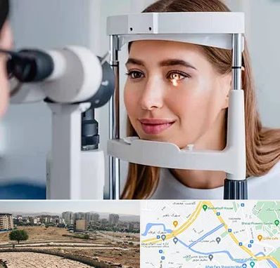 دکتر قوز قرنیه در کوی وحدت شیراز