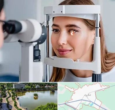 دکتر قوز قرنیه در لنگرود