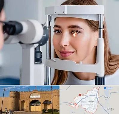 دکتر قوز قرنیه در ایرانشهر