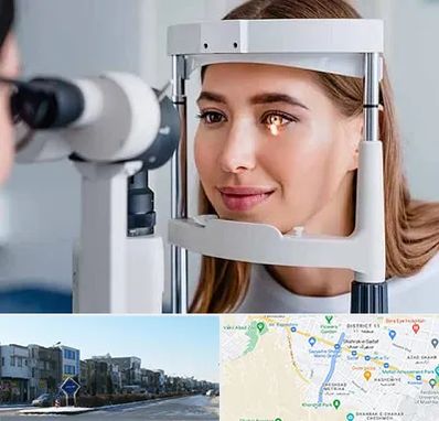 دکتر قوز قرنیه در شریعتی مشهد