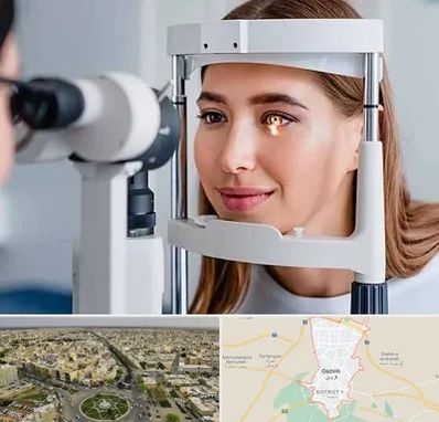 دکتر قوز قرنیه در قزوین