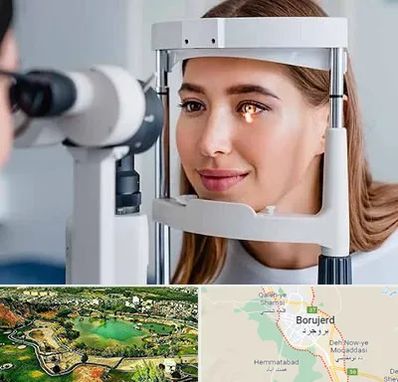 دکتر قوز قرنیه در بروجرد