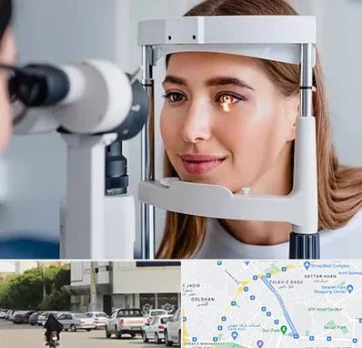 دکتر قوز قرنیه در قدوسی شرقی شیراز