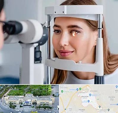 دکتر قوز قرنیه در نسیم شهر
