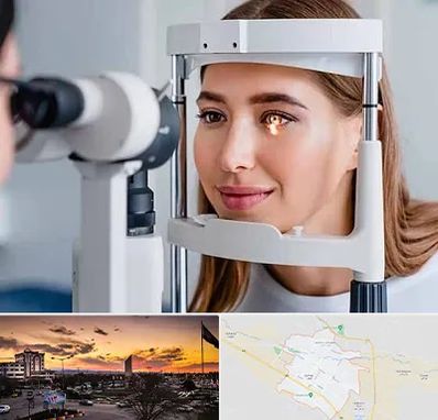 دکتر قوز قرنیه در قوچان