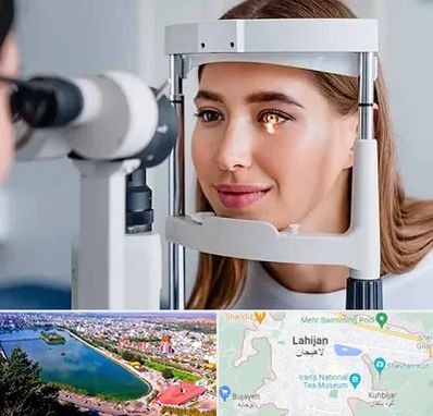 دکتر قوز قرنیه در لاهیجان