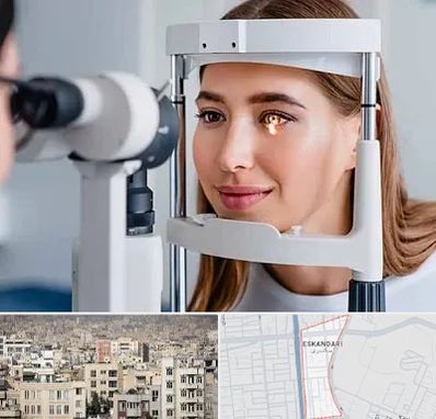 دکتر قوز قرنیه در اسکندری