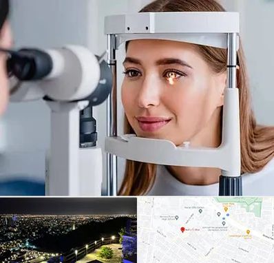 دکتر قوز قرنیه در هفت تیر مشهد