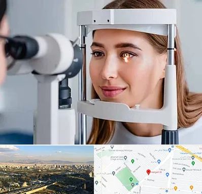 دکتر قوز قرنیه در هنگام