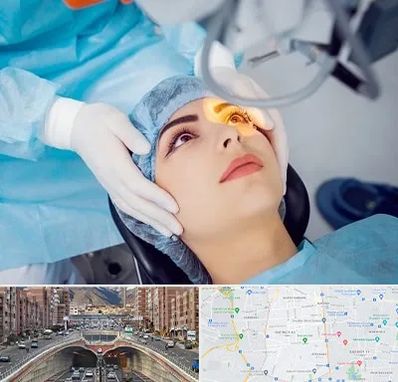 دکتر عمل لیزیک چشم در منطقه 10 تهران