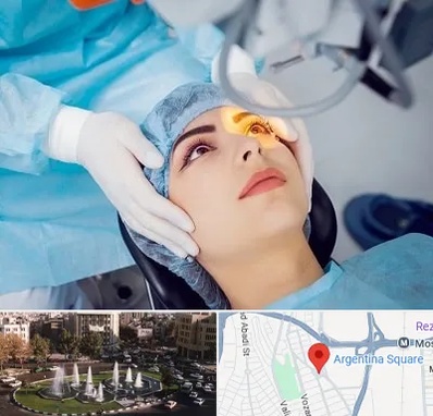 دکتر عمل لیزیک چشم در آرژانتین