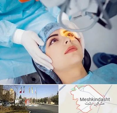 دکتر عمل لیزیک چشم در مشکین دشت