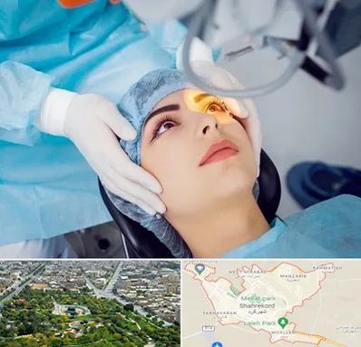دکتر عمل لیزیک چشم در شهرکرد
