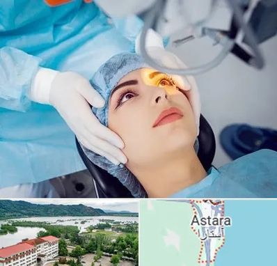 دکتر عمل لیزیک چشم در آستارا